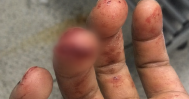 PAI É ACUSADO DE TENTAR MATAR OS FILHOS COM FACÃO APÓS DISCUSSÃO DENTRO DE CASA