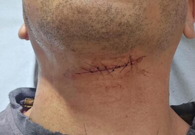 LINHA COM CEROL CORTA PESCOÇO DE MOTOCICLISTA EM SÃO JOSÉ E ACENDE ALERTA NO SETVILLE