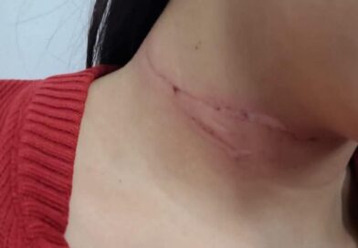 FIO BAIXO NO CAMINHO DO TRABALHO: MOTOCICLISTA TEM PESCOÇO CORTADO POR CABO E CAI EM AVENIDA DE CARAGUÁ