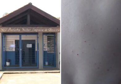 SUSPEITA DE SURTO DE SARNA AFASTA 54 PESSOAS DE ESCOLA EM ATIBAIA; FUNCIONÁRIA RELATA COCEIRA INTENSA ATÉ DURANTE A MADRUGADA